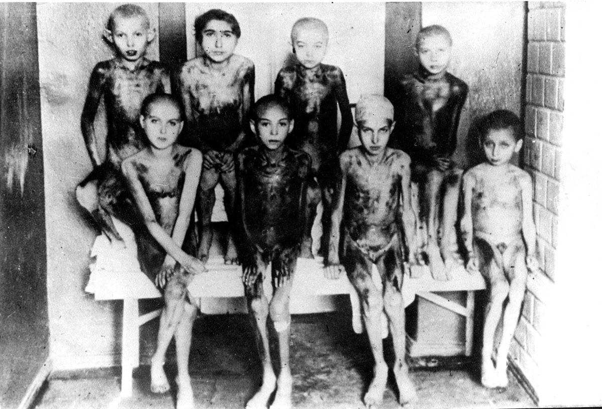 photo taken between 1940 and 1945 in Oswiecim, of naked children in the Auschwitz concentration camp, apparently after medical experiments