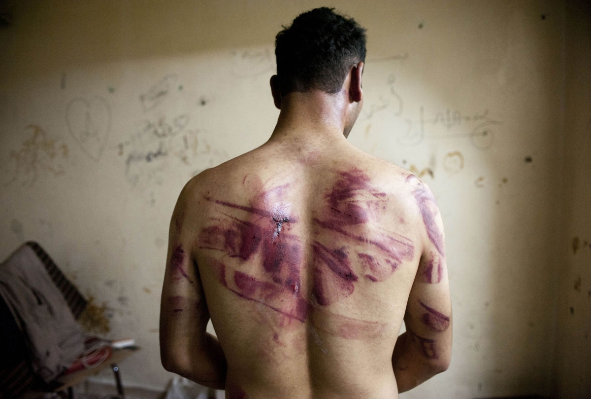 A Syrian man shows marks of torture on his back, after he was released from regime forces, in the Bustan Pasha neighbourhood of Syria's northern city of Aleppo on August 23, 2012.