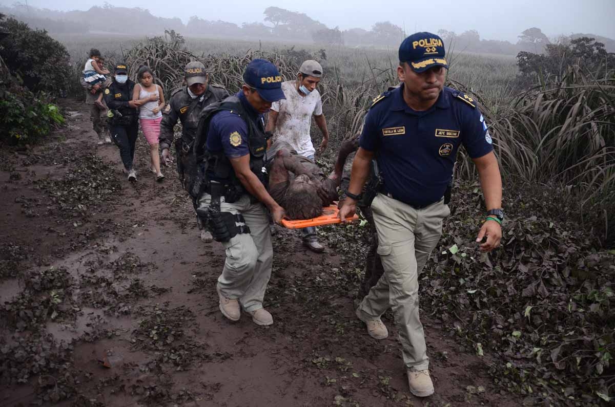 A officer police carries a man with a wounded after the eruption of the Fuego Volcano in El Rodeo village, Escuintla department, 35 km south of Guatemala City on June 3, 2018.