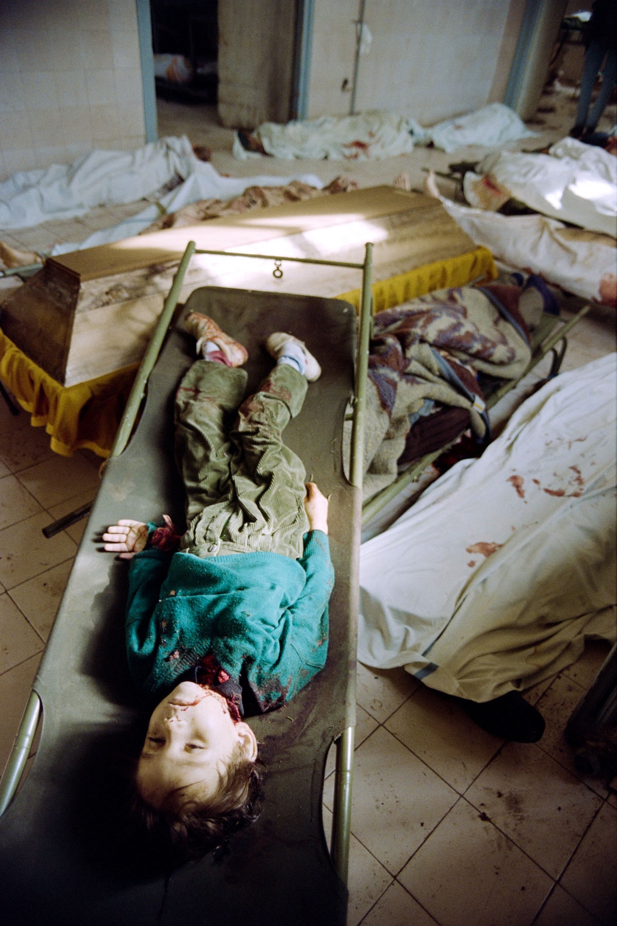 The body of a child killed by shelling lies on a stretcher upon a coffin and other bodies on June 07, 1992 in the Sarajevo mortuary hospital, full of dead people who can't be burried because families are afraid of bombing and snipers during funerals.