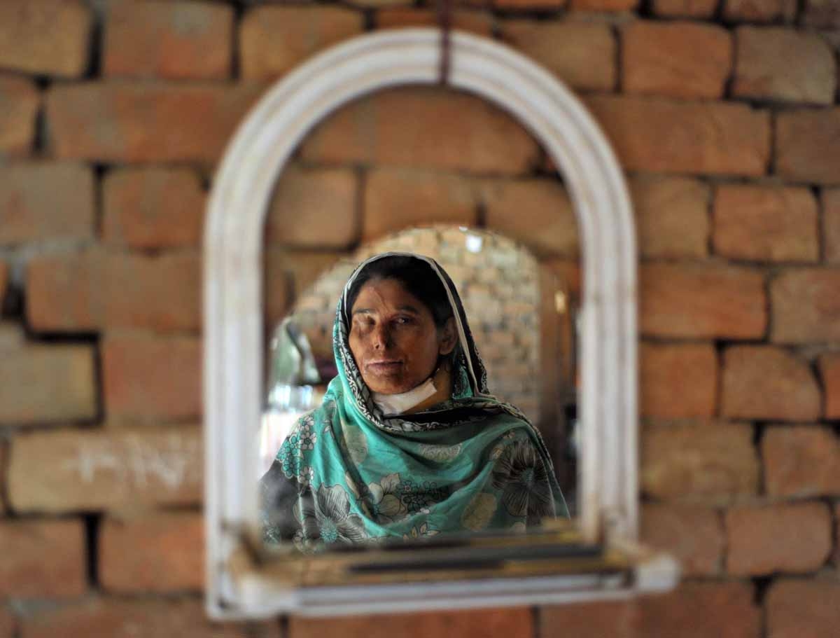 Acid attack victim Asiya Bibe, 35, is seen in a mirror as she poses at her residence at Bahawalpur district in Multan on March 16, 2012. Acid attack victim Asiya Bibe, 35, is seen in a mirror as she poses at her residence at Bahawalpur district in Multan on March 16, 2012.