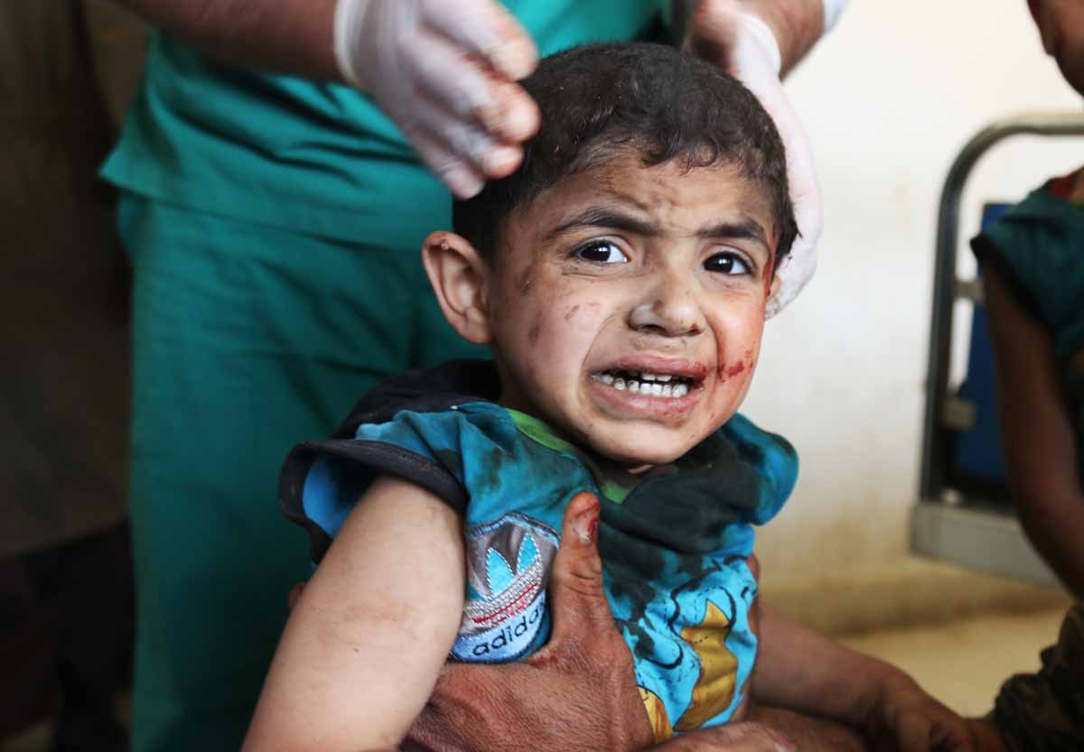 A Syrian child receives treatment at a makeshift hospital following an air strike on a vegetable market in Maaret al-Numan, in Syria's northern province of Idlib, on April 19, 2016. A Syrian child receives treatment at a makeshift hospital following an air strike on a vegetable market in Maaret al-Numan, in Syria's northern province of Idlib, on April 19, 2016.
