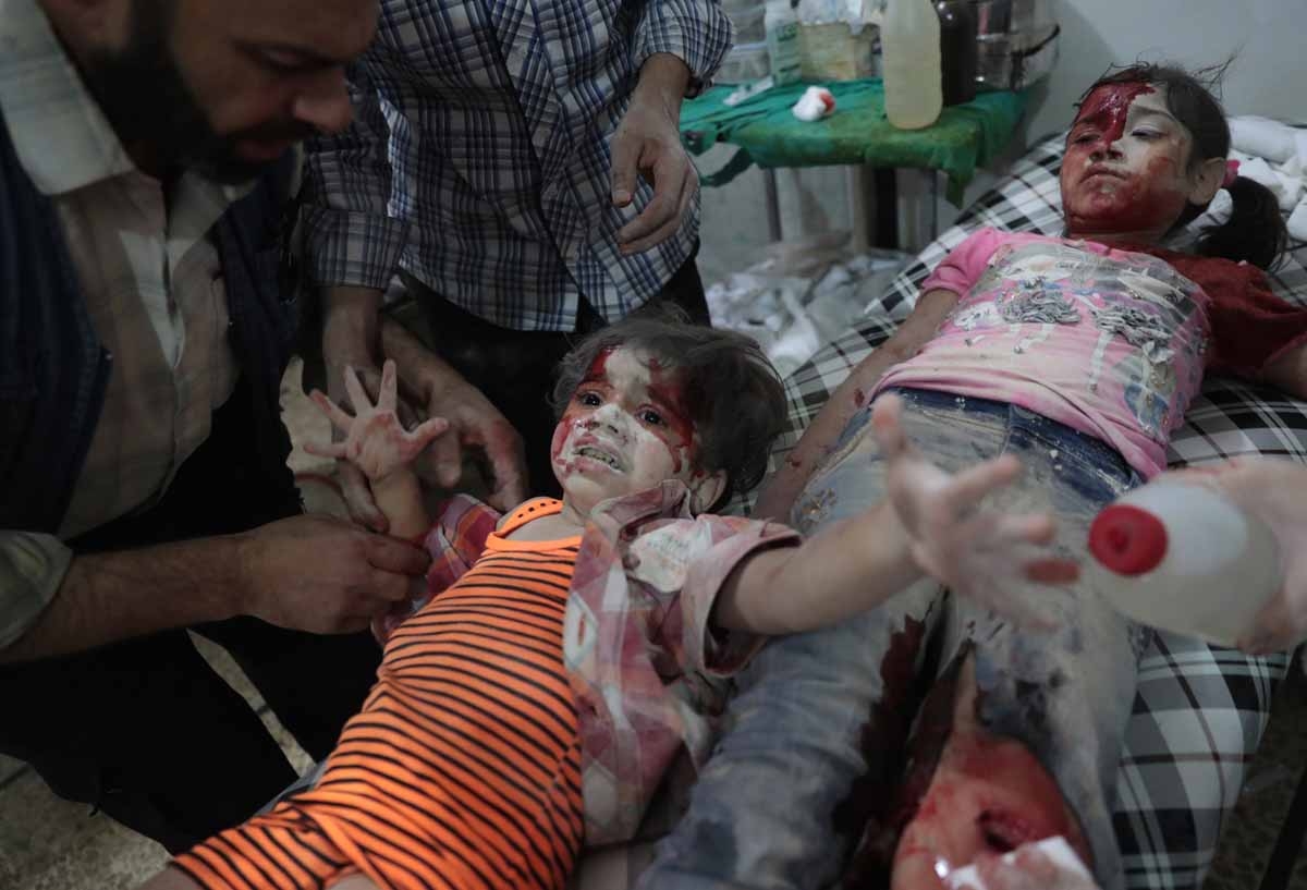 A Syrian girl reacts in pain as a wounded child lies next to her at a make-shift hospital following reported government air strikes on the rebel-held town of Douma, east of the capital Damascus on September 12, 2016.
