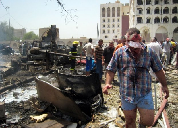 A wounded man leaves the scene of a massive explosion outside the foreign ministry in a residential area close to the Green Zone in central Baghdad on August 19, 2009. A wounded man leaves the scene of a massive explosion outside the foreign ministry in a residential area close to the Green Zone in central Baghdad on August 19, 2009.