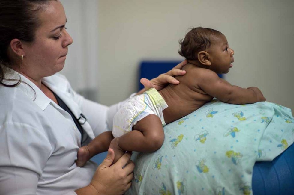 A physical therapist with a microcephalia-afflicted infant in Salvador, Brazil. January, 2016. A physical therapist with a microcephalia-afflicted infant in Salvador, Brazil. January, 2016.