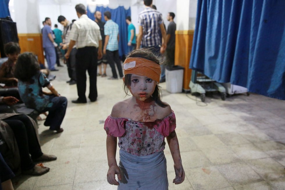 A wounded Syrian girl in a makeshift hospital in Douma, following shelling and air raids by Syrian government forces on August 22, 2015 A wounded Syrian girl in a makeshift hospital in Douma, following shelling and air raids by Syrian government forces on August 22, 2015