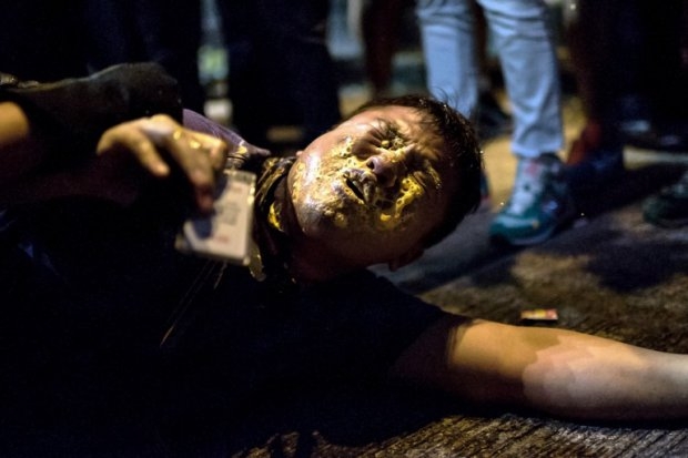 A local Hong Kong journalist shows his company credentials after collapsing to the ground following being pepper sprayed by police in the Mongkok district of Hong Kong on October 17, 2014 (AFP Photo / Alex Ogle) A local Hong Kong journalist shows his company credentials after collapsing to the ground following being pepper sprayed by police in the Mongkok district of Hong Kong on October 17, 2014 (AFP Photo / Alex Ogle)