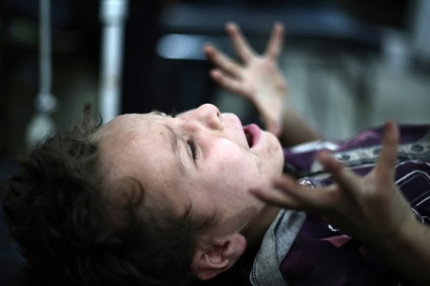 A boy screams as a doctor removes shrapnel from his leg in Douma, Syria, on July 3, 2014 A boy screams as a doctor removes shrapnel from his leg in Douma, Syria, on July 3, 2014