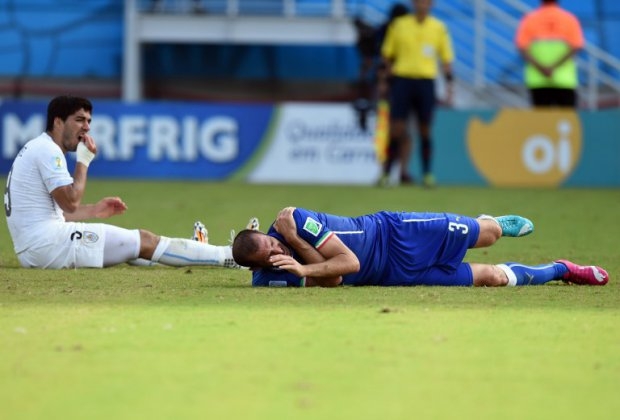 Luis Suarez and Giorgio Chiellini after the bite Luis Suarez and Giorgio Chiellini after the bite