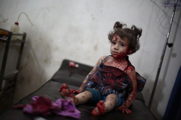 An injured girl looks on as she is being treated at a makeshift hospital in the besieged rebel bastion of Douma, northeast of the Syrian capital Damascus, on September 24, 2014 An injured girl looks on as she is being treated at a makeshift hospital in the besieged rebel bastion of Douma, northeast of the Syrian capital Damascus, on September 24, 2014