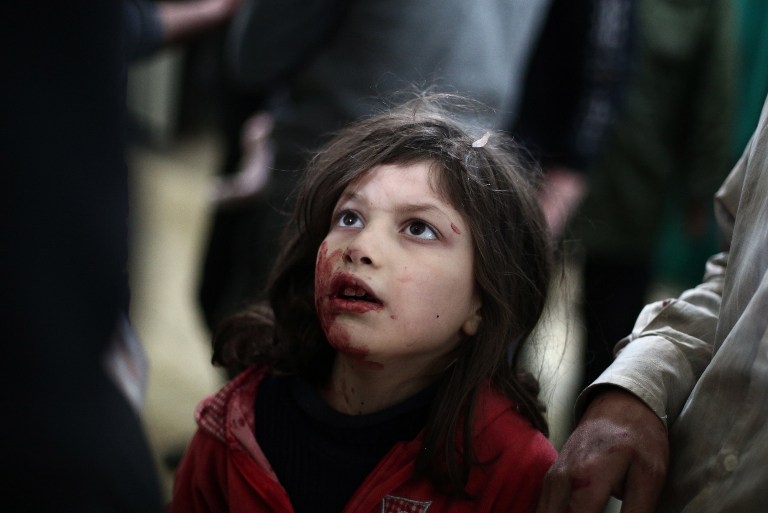 An injured Syrian girl at a makeshift clinic in Douma, Syria on February 5, 2015 An injured Syrian girl at a makeshift clinic in Douma, Syria on February 5, 2015