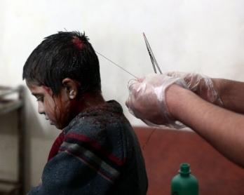 A medic stitches the head of a wounded boy at a makeshift clinic after a mortar fired by Syrian government forces fell in the besieged rebel town of Douma, in the outskirts of Damascus, on November 11, 2014 (AFP Photo Abd Doumany)